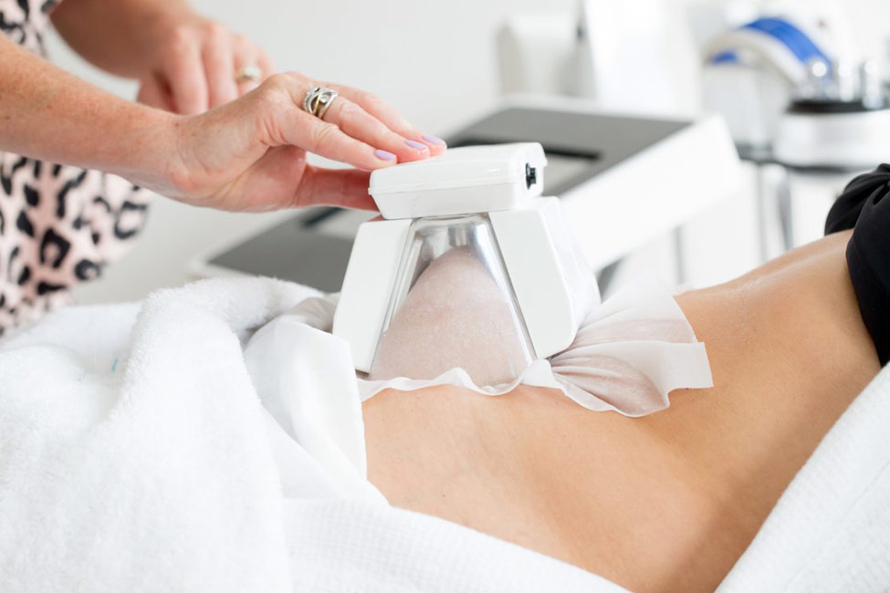 CRYOLIPOLYSIS - Fat Freezing Treatment