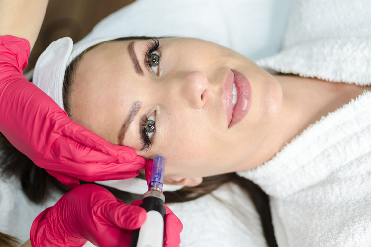 Dermapen