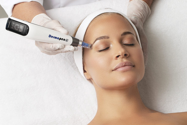 Dermapen Treatment with UBER PRO Peel