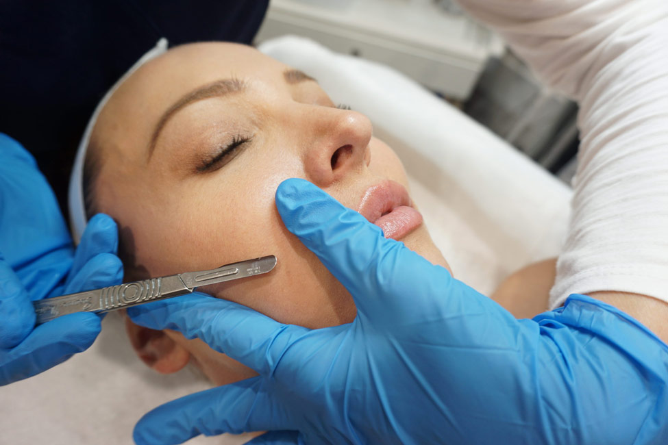 Dermaplaning Treatment