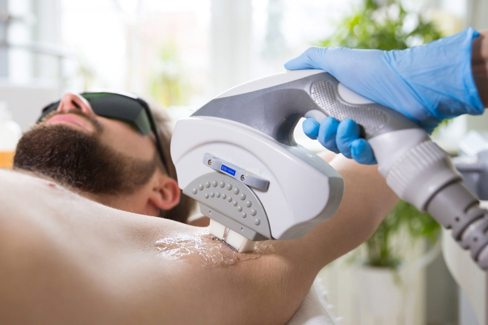Laser Hair Removal
