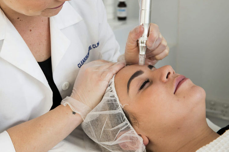 Mesotherapy SKINfusion