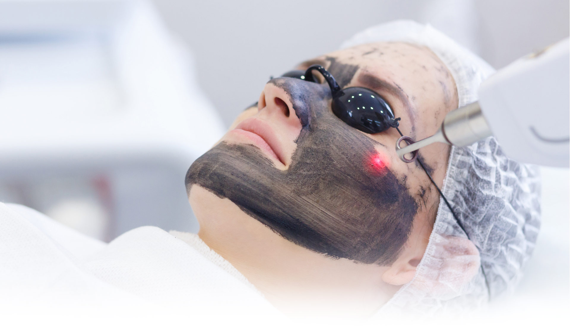 Carbon Laser Peel Hero